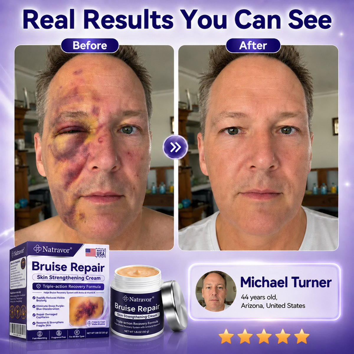 Natravor® cream to repair bruises and strengthen the skin.