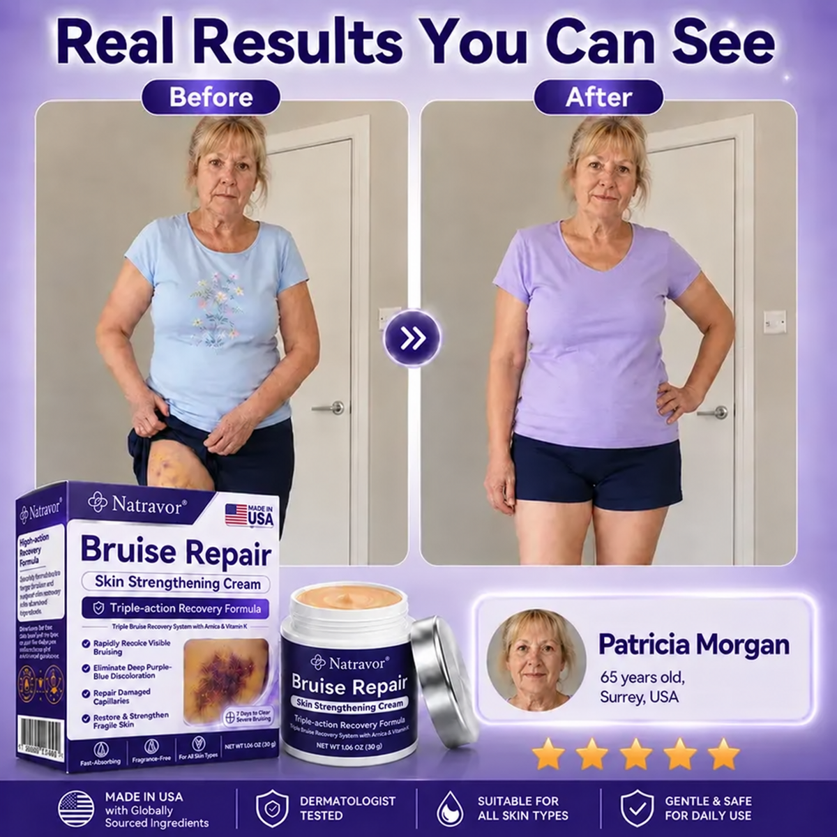 Natravor® cream to repair bruises and strengthen the skin.